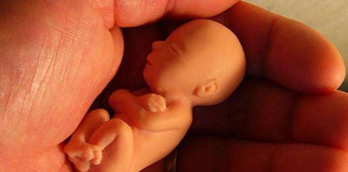 ¿Por qué el aborto debe ser penalizado?
