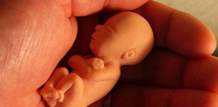 Las 10 frases más reveladoras que se les escaparon a médicos abortistas