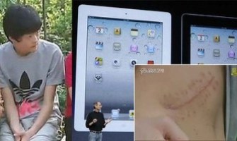 Parece mentira: ¡Un joven chino vende un riñón para comprarse un iPad 2!