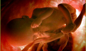 ‘El aborto no se puede considerar una terapia’, Dr. Renzo Paccini